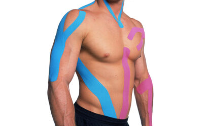 Kinesio Taping