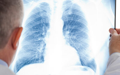 Pneumologia