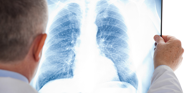 Pneumologia