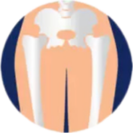 Anca