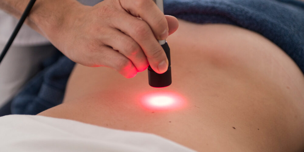 Laserterapia ad alta potenza