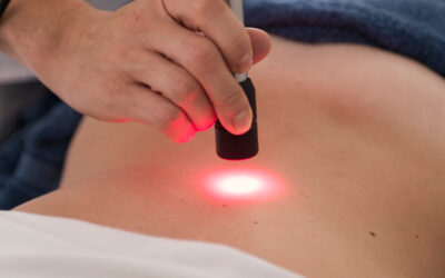 Laserterapia ad alta potenza