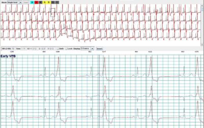 Holter