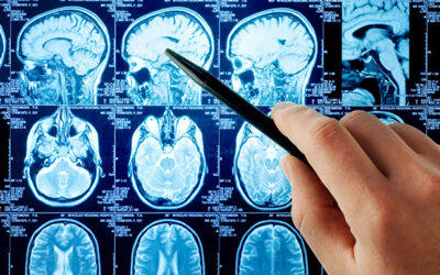 Neurologia