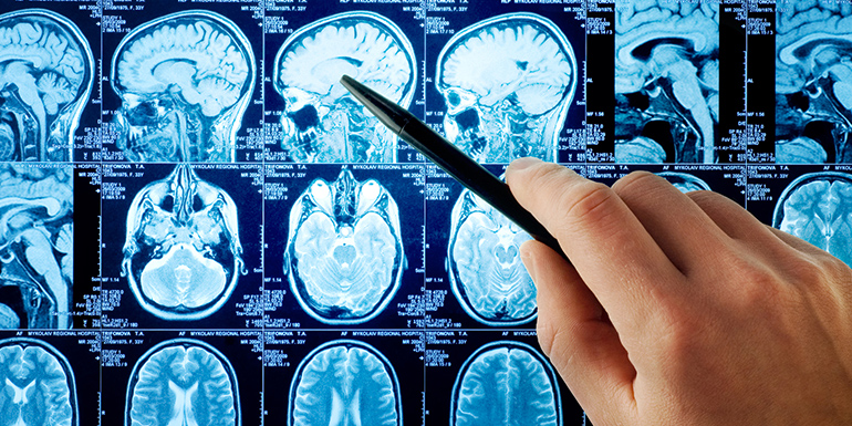 Neurologia