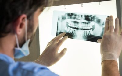 Panoramica Dentale