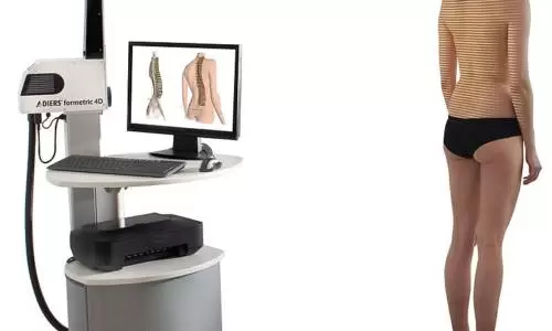 Formetric, una nuova frontiera per diagnosi e cura delle patologie vertebrali
