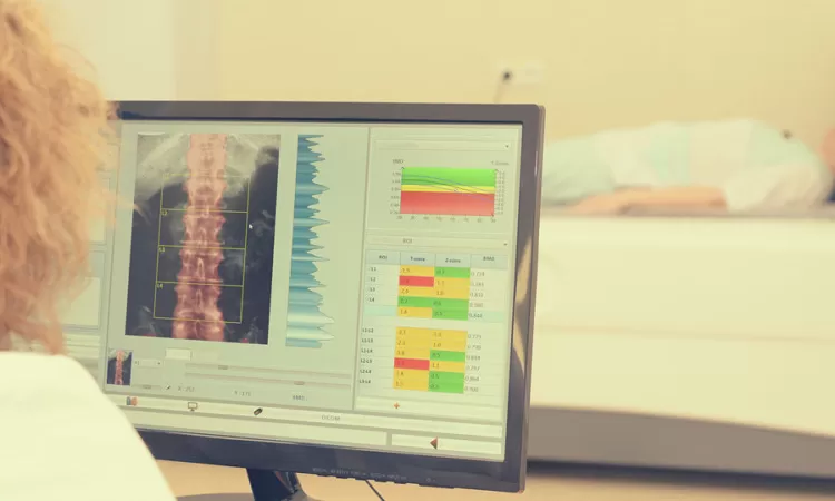 L&rsquo;osteoporosi, malattia silenziosa: quando prevenire &egrave; vitale