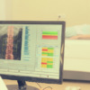 L’osteoporosi, malattia silenziosa: quando prevenire è vitale